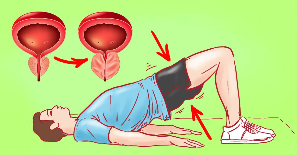 gymnastické cvičenia na prostatitídu